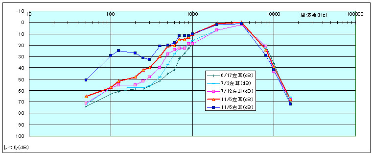 自前の耳感度検査